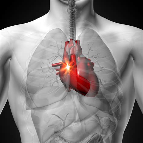 Heart Problems .